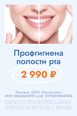 Гигиена полости рта за 2990 рублей!